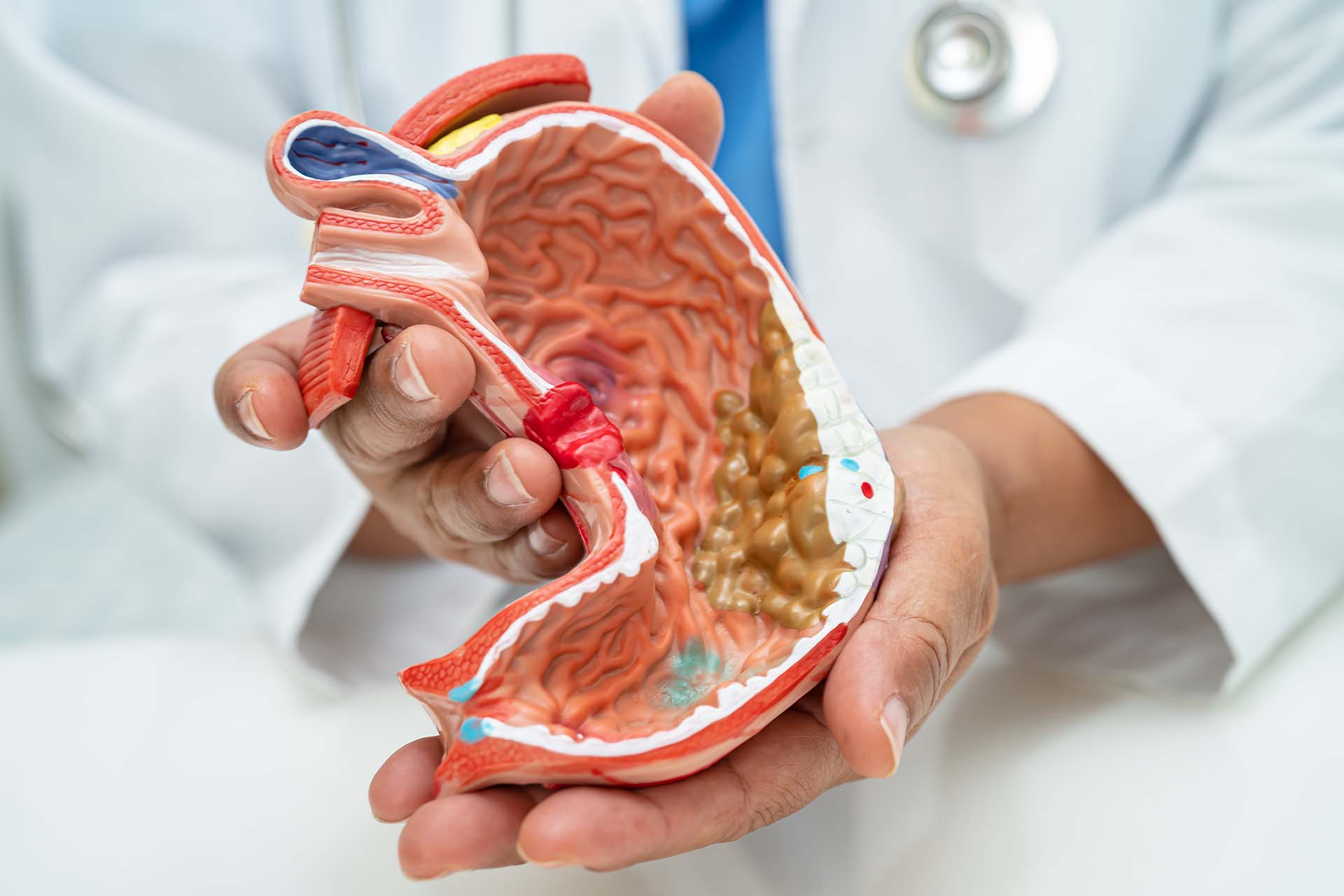 weight loss drug Ozempic medical side effect review